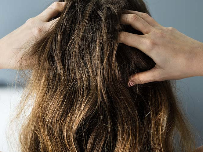 Juckende oder trockene Kopfhaut