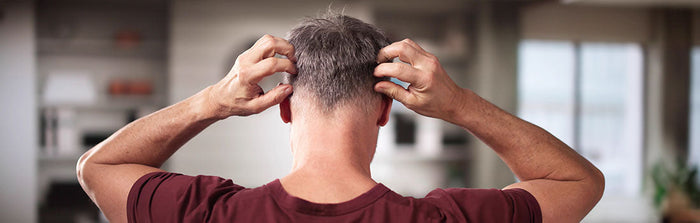 Mann mit fettigen Schuppen