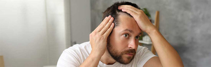 Mann mit Haarausfall schaut besorgt in den Spiegel