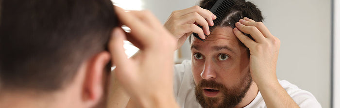 Mann mit Schuppen auf der Kopfhaut