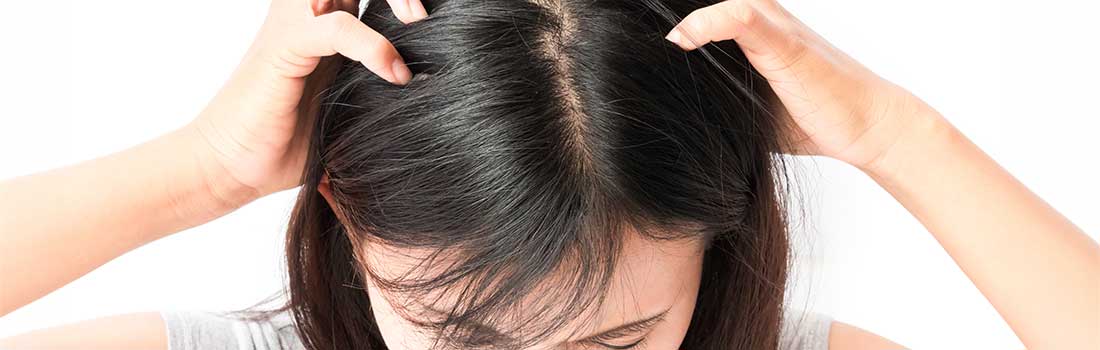 Nissen oder Schuppen