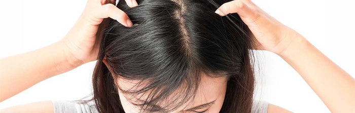 Nissen oder Schuppen